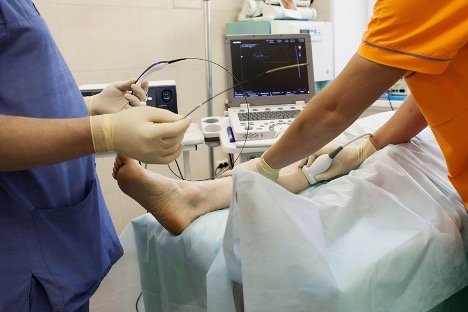 What Makes ClariVein Different? A Complete Patient’s Guide